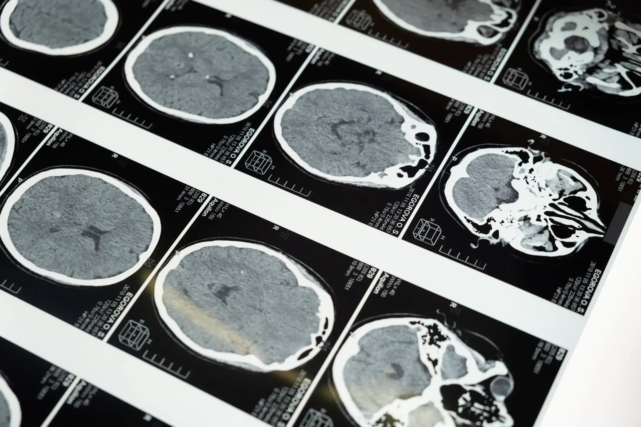 Every step of data collection costs the patient money